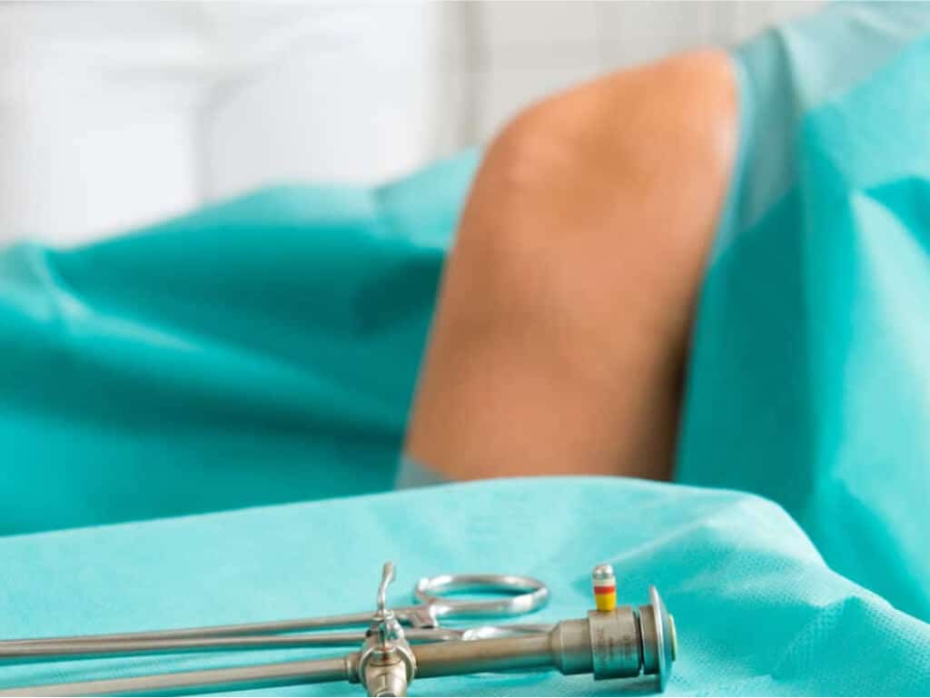 Knie vor einer Operation Mensikusriss Kreuzbandriss künstliches Kniegelenk Arthroskopie