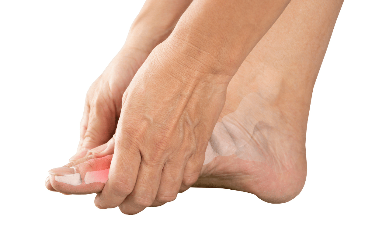 Frau hält sich Fuß mit Schmerzen an Gelenk, Knochen, Arthrose, Arthritis, Gicht