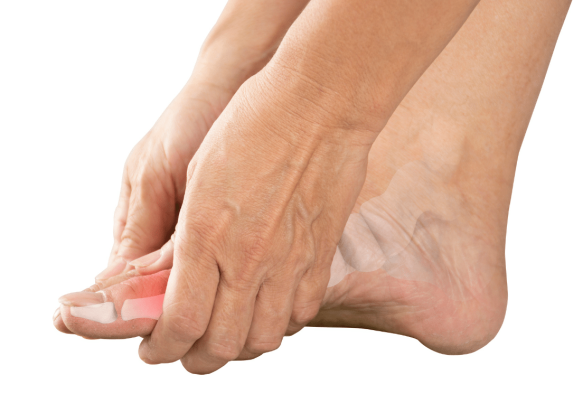 Frau hält sich Fuß mit Schmerzen an Gelenk, Knochen, Arthrose, Arthritis, Gicht